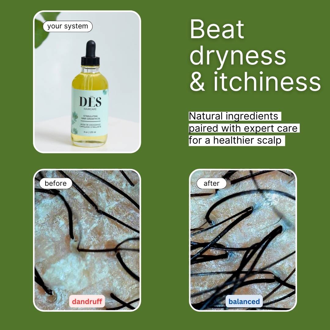 Soothing Hair Growth Oil
